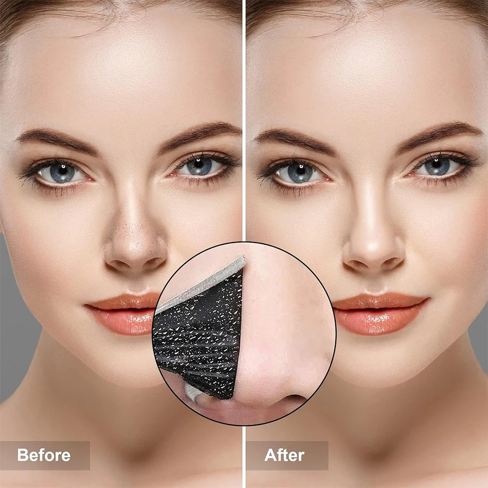 10PCS Unisex Blackhead Remove  - Skincare Indonesia reseña y precio