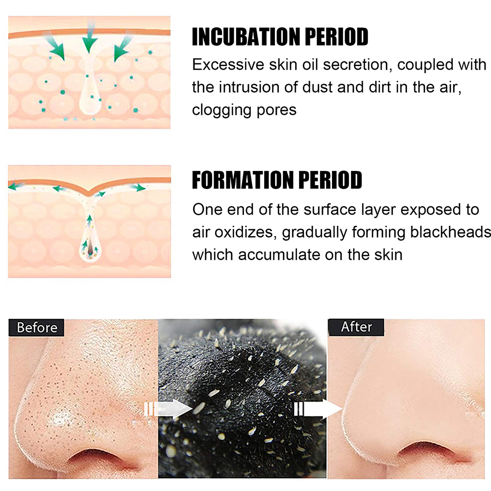 10PCS Unisex Blackhead Remove  - Skincare Indonesia reseña y precio