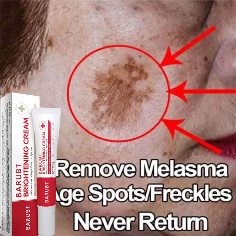 Powerful Spot-removing Whiteni - Skincare Vitamin C reseña y precio