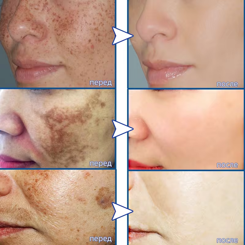Powerful Spot-removing Whiteni - Skincare Vitamin C reseña y precio