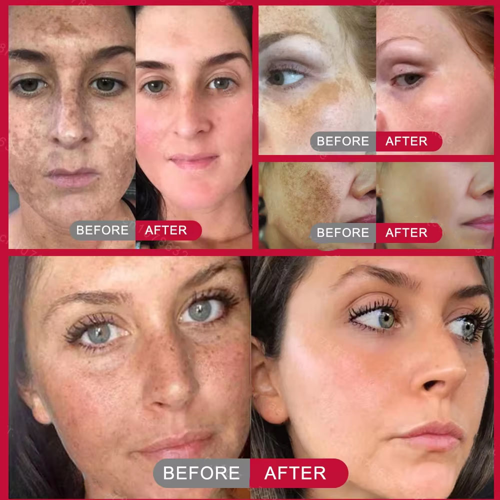 Powerful Spot-removing Whiteni - Skincare Vitamin C reseña y precio