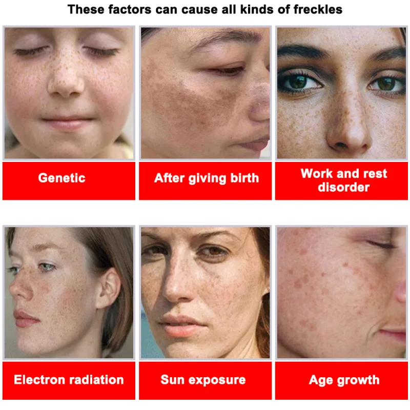 Powerful Spot-removing Whiteni - Skincare Vitamin C reseña y precio