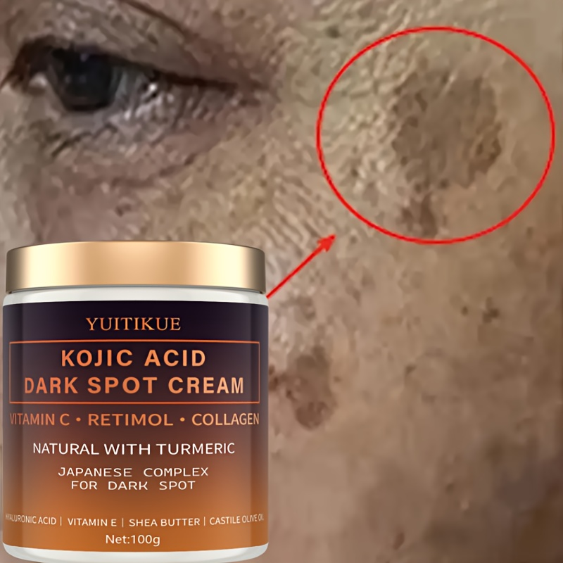 Arbutin fading cream, Vitamin  - Skincare Vitamin C reseña y precio