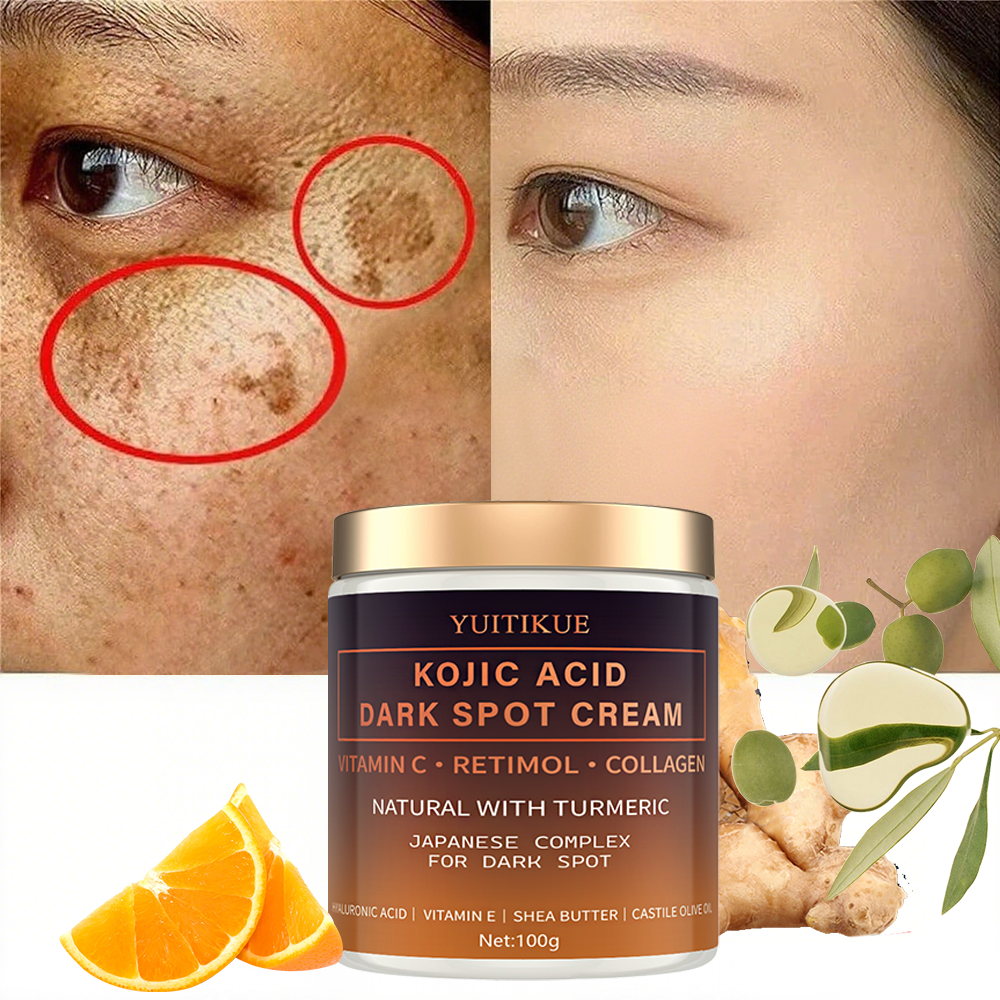 Arbutin fading cream, Vitamin  - Skincare Vitamin C reseña y precio
